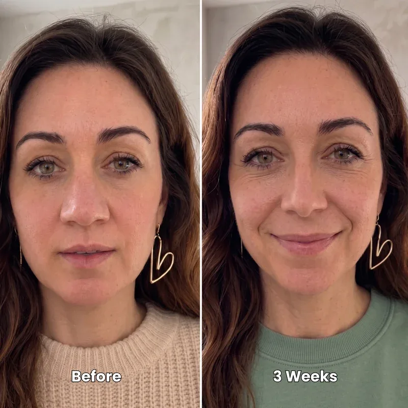 Ashley T. before and after 3 weeks of using the Fynoura sculpting routine